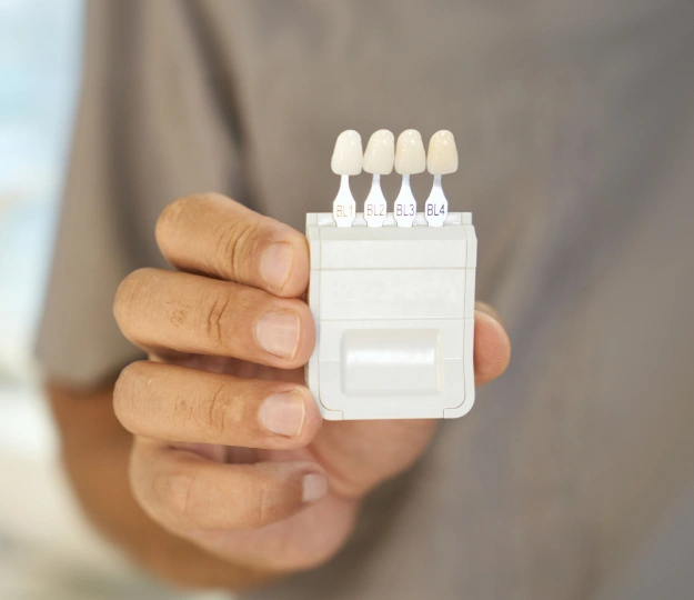 Hand holding a row of dental veneer samples against a white background