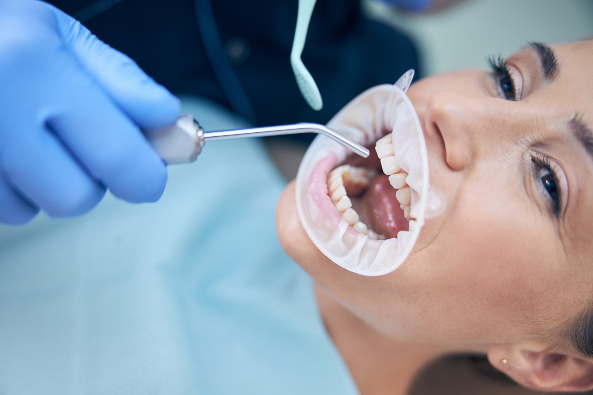 Dentist examining a patient's teeth for gray or dark discoloration